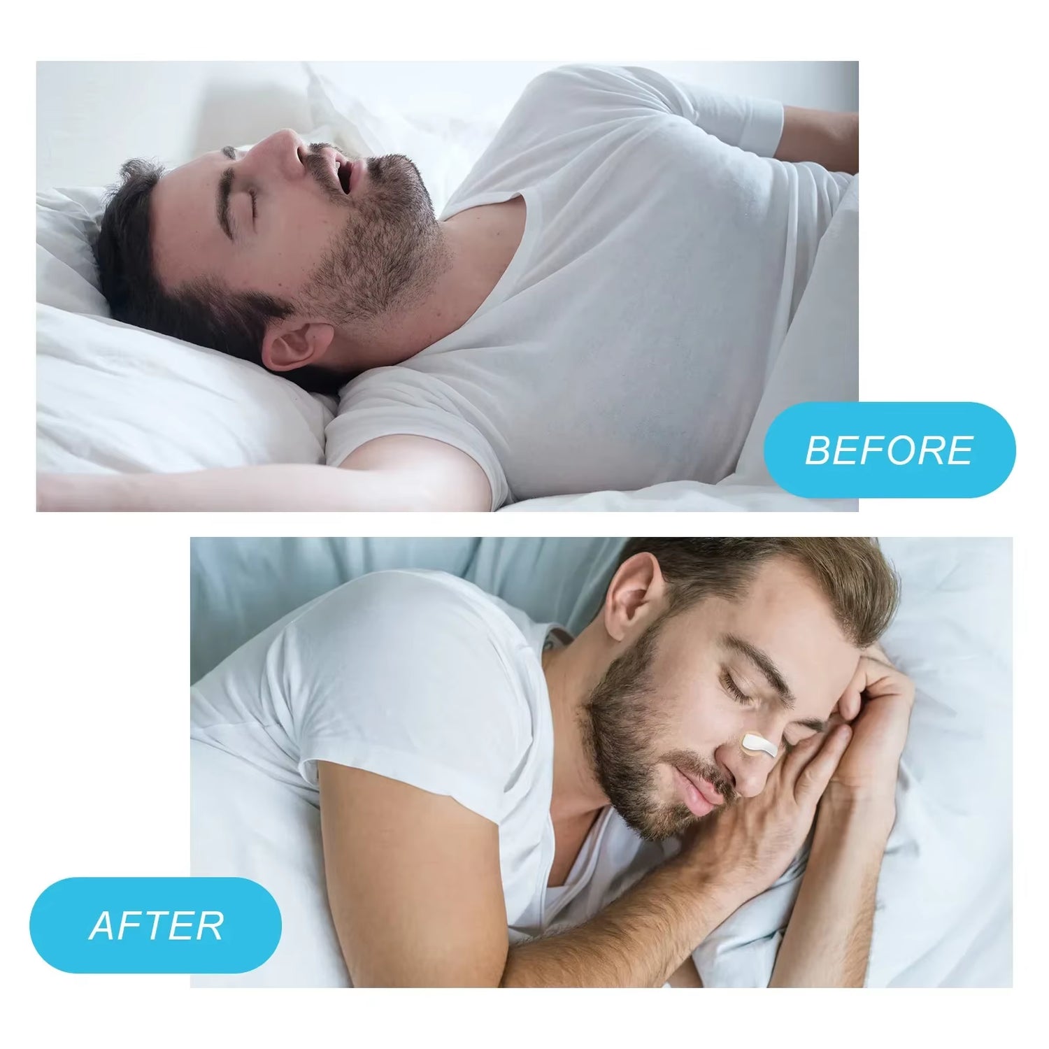Nose Strips Magnetic Nasal Breathing Nose Dilators Nasal Strips Nasal Clip anti Snoring Improve Sleeping Aid Preventing Snoring
